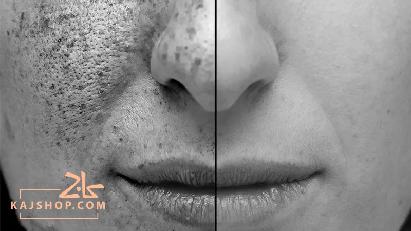 استفاده از کرم ضد آفتاب تاریخ گذشته